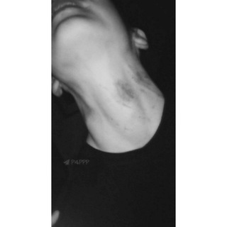 حِـآء ، ??'ء